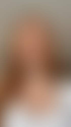 Geblurrte Content-Vorschau
