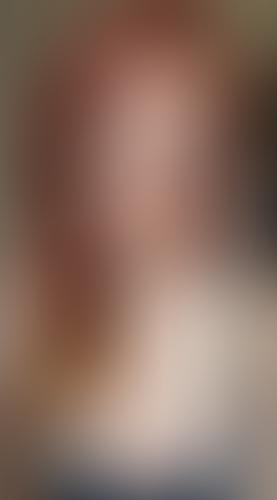 Geblurrte Content-Vorschau
