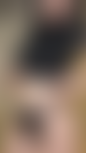 Geblurrte Content-Vorschau