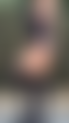 Geblurrte Content-Vorschau