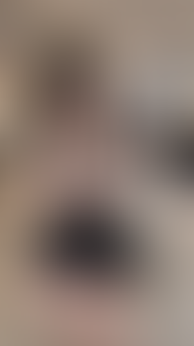 Geblurrte Content-Vorschau