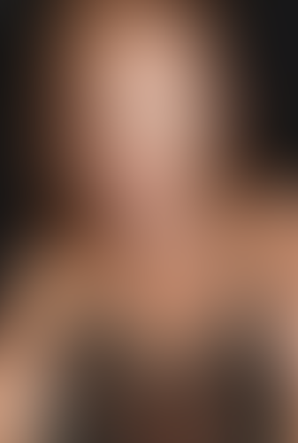 Geblurrte Content-Vorschau