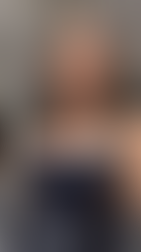 Geblurrte Content-Vorschau