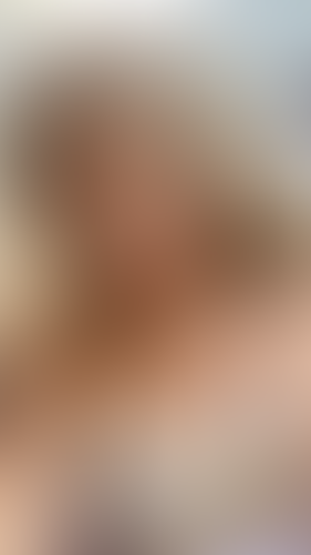 Geblurrte Content-Vorschau