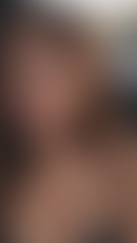 Geblurrte Content-Vorschau