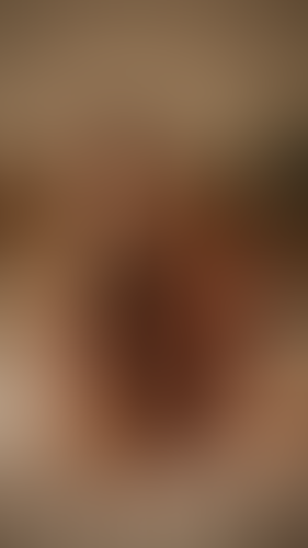 Geblurrte Content-Vorschau