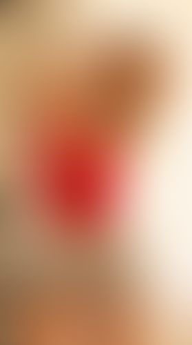 Geblurrte Content-Vorschau