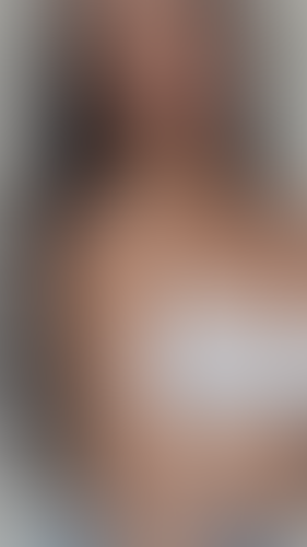 Geblurrte Content-Vorschau