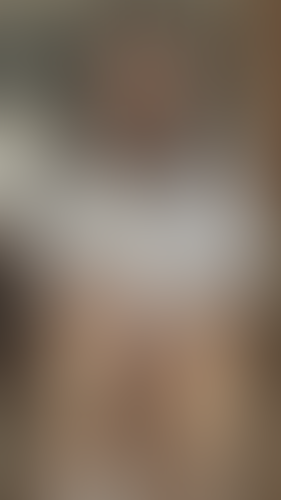 Geblurrte Content-Vorschau
