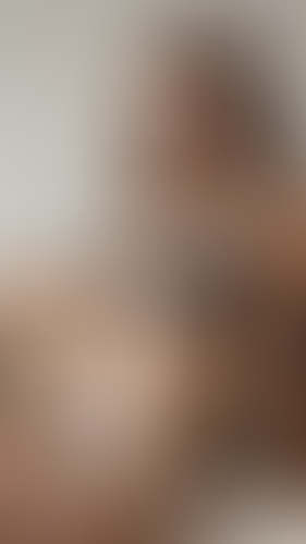 Geblurrte Content-Vorschau