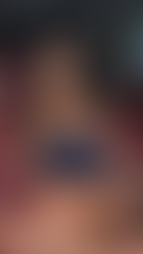 Geblurrte Content-Vorschau
