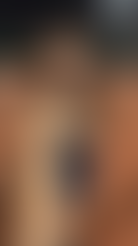 Geblurrte Content-Vorschau