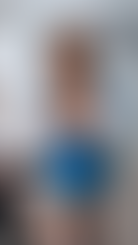 Geblurrte Content-Vorschau