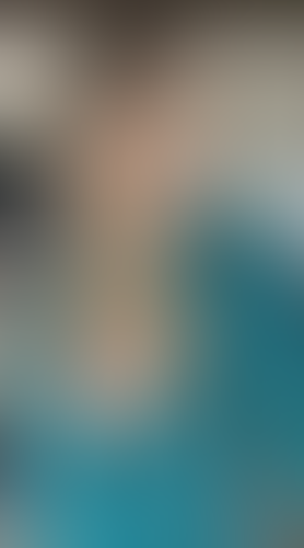 Geblurrte Content-Vorschau