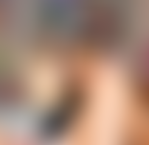 Geblurrte Content-Vorschau