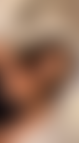Geblurrte Content-Vorschau