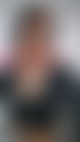 Geblurrte Content-Vorschau