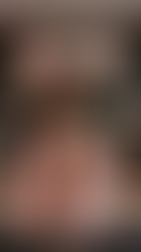 Geblurrte Content-Vorschau
