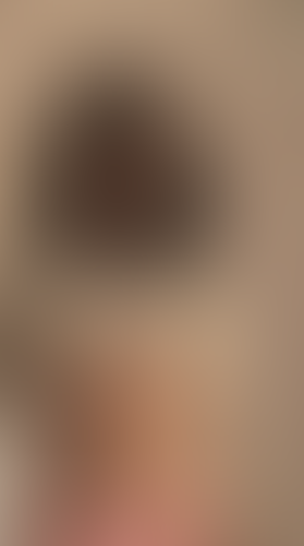 Geblurrte Content-Vorschau