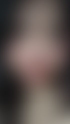 Geblurrte Content-Vorschau