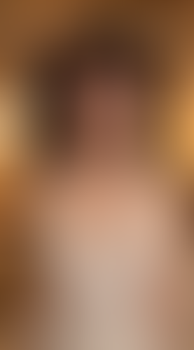 Geblurrte Content-Vorschau