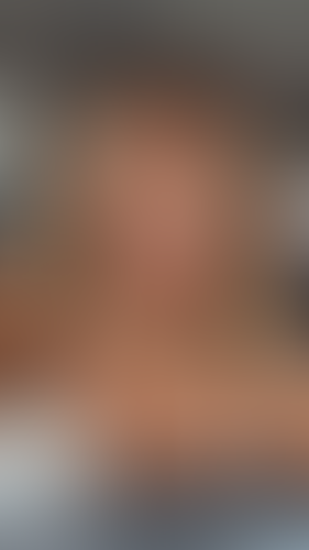 Geblurrte Content-Vorschau