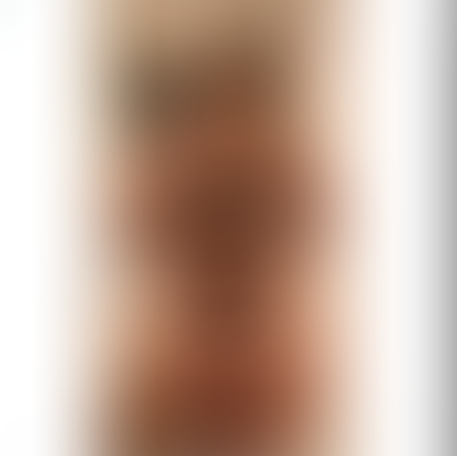 Geblurrte Content-Vorschau