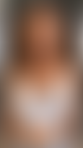 Geblurrte Content-Vorschau