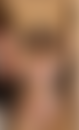 Geblurrte Content-Vorschau