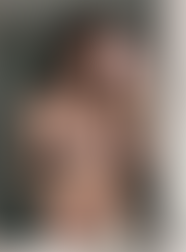 Geblurrte Content-Vorschau