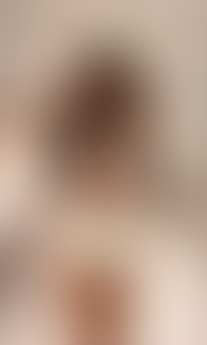 Geblurrte Content-Vorschau