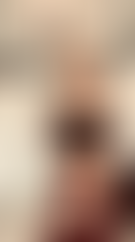 Geblurrte Content-Vorschau