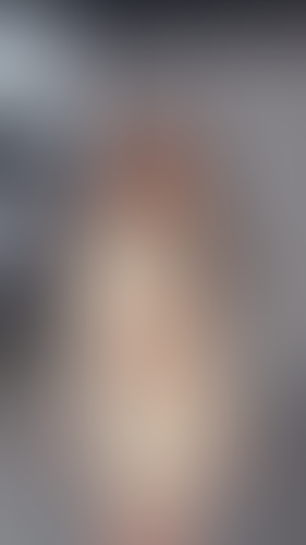 Geblurrte Content-Vorschau