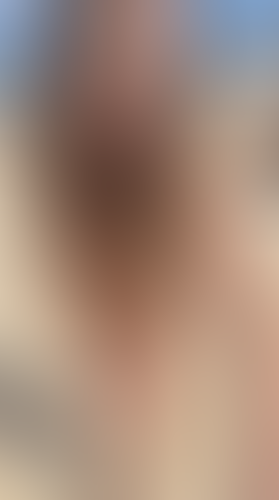 Geblurrte Content-Vorschau