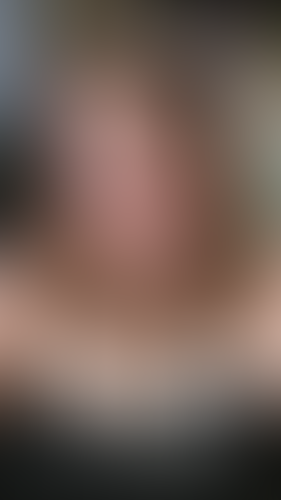 Geblurrte Content-Vorschau
