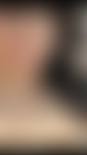 Geblurrte Content-Vorschau