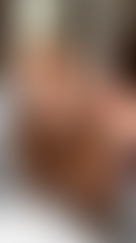 Geblurrte Content-Vorschau