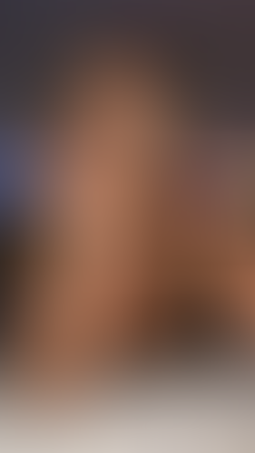 Geblurrte Content-Vorschau