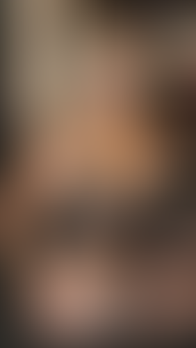 Geblurrte Content-Vorschau