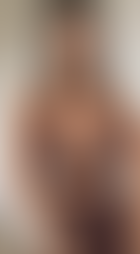 Geblurrte Content-Vorschau