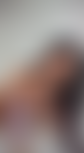 Geblurrte Content-Vorschau