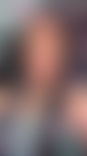 Geblurrte Content-Vorschau