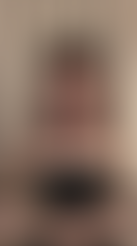 Geblurrte Content-Vorschau