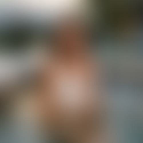 Geblurrte Content-Vorschau