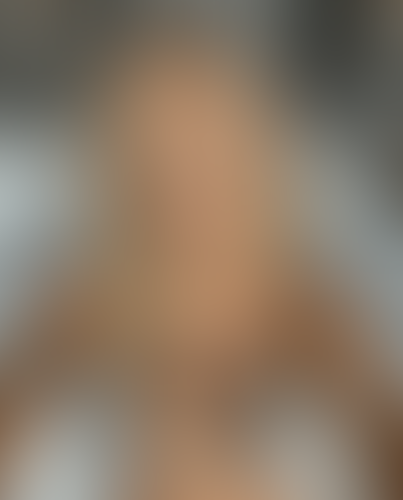 Geblurrte Content-Vorschau