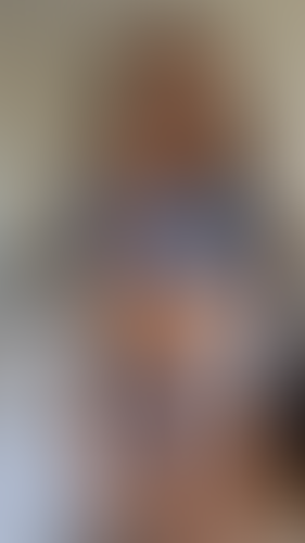 Geblurrte Content-Vorschau
