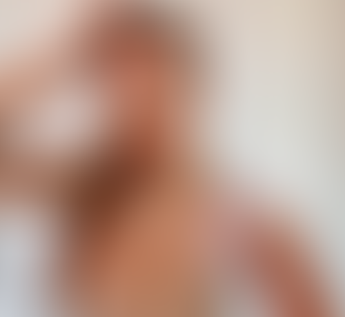 Geblurrte Content-Vorschau