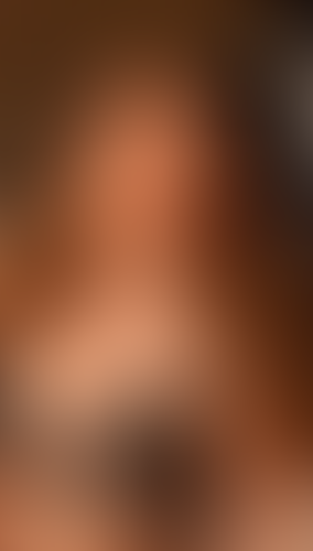 Geblurrte Content-Vorschau