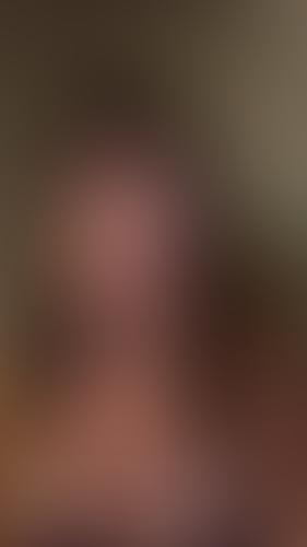 Geblurrte Content-Vorschau