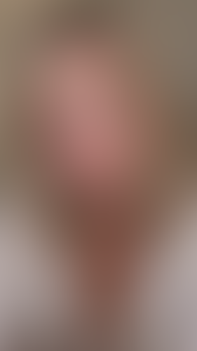 Geblurrte Content-Vorschau
